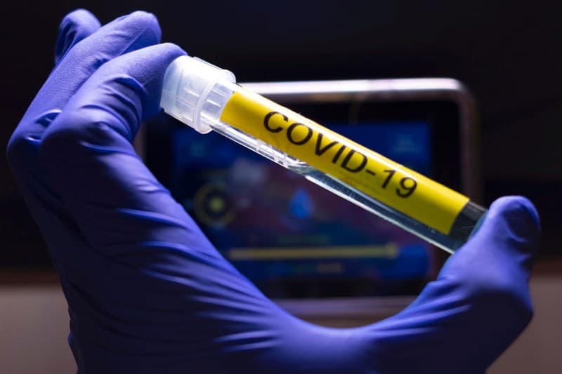 Covid-19: países manifestam interesse em acesso global a vacinas