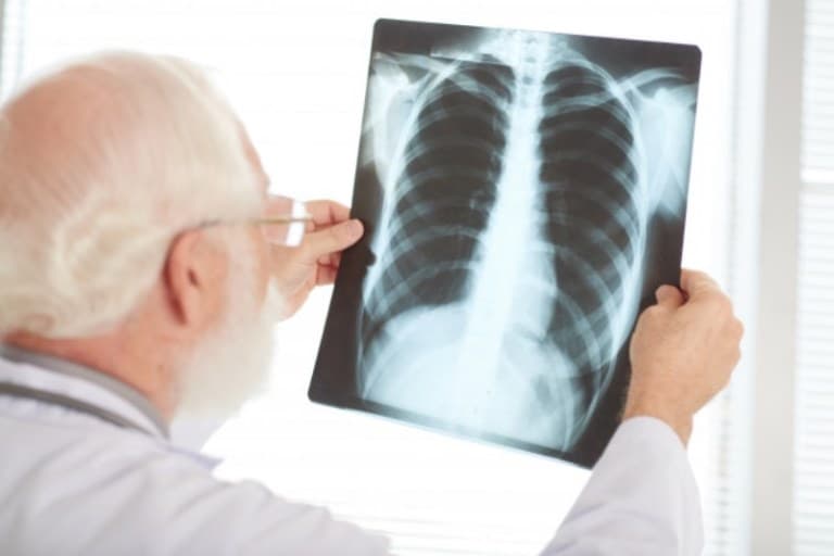Pesquisa mostra aumento de mortes por sindromes respiratórias graves