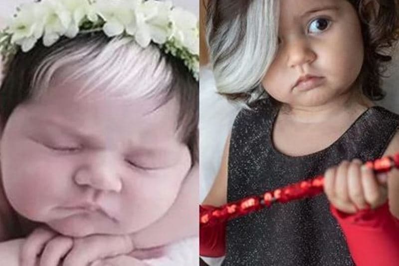 menina com mecha branca no cabelo