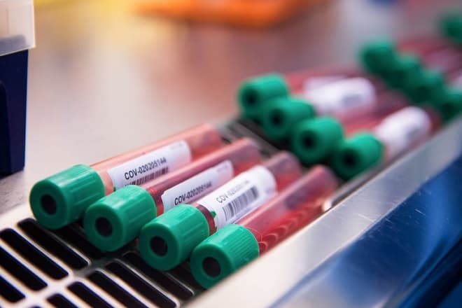 OMS: vacina da AstraZeneca previne infecções e reduz mortes de COVID-19