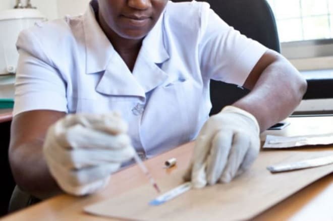 Pessoas com HIV têm o dobro de risco de morrer por Covid-19
