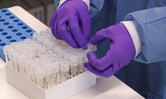 InfoGripe aponta aumento moderado de casos de SRAG e Covid-19 no MA