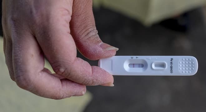 Covid: associação recomenda testar só para quem tem sintomas fortes