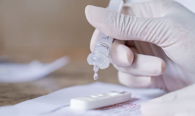 Covid-19: testes rápidos estão incluídos nos planos de saúde