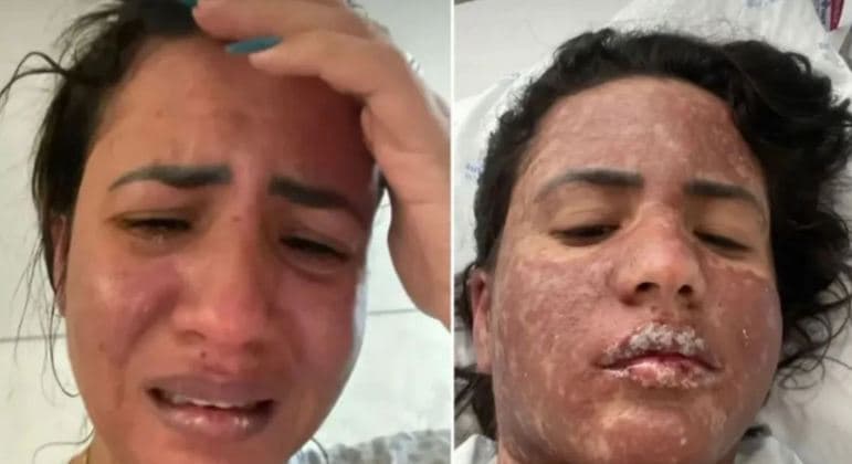 Entenda a síndrome rara que acomete a mulher de Frank Aguiar