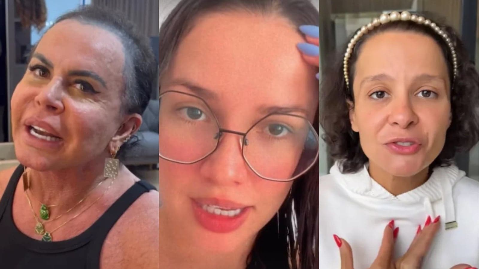 Alopecia: casos entre famosas acendem alerta para queda de cabelo; entenda