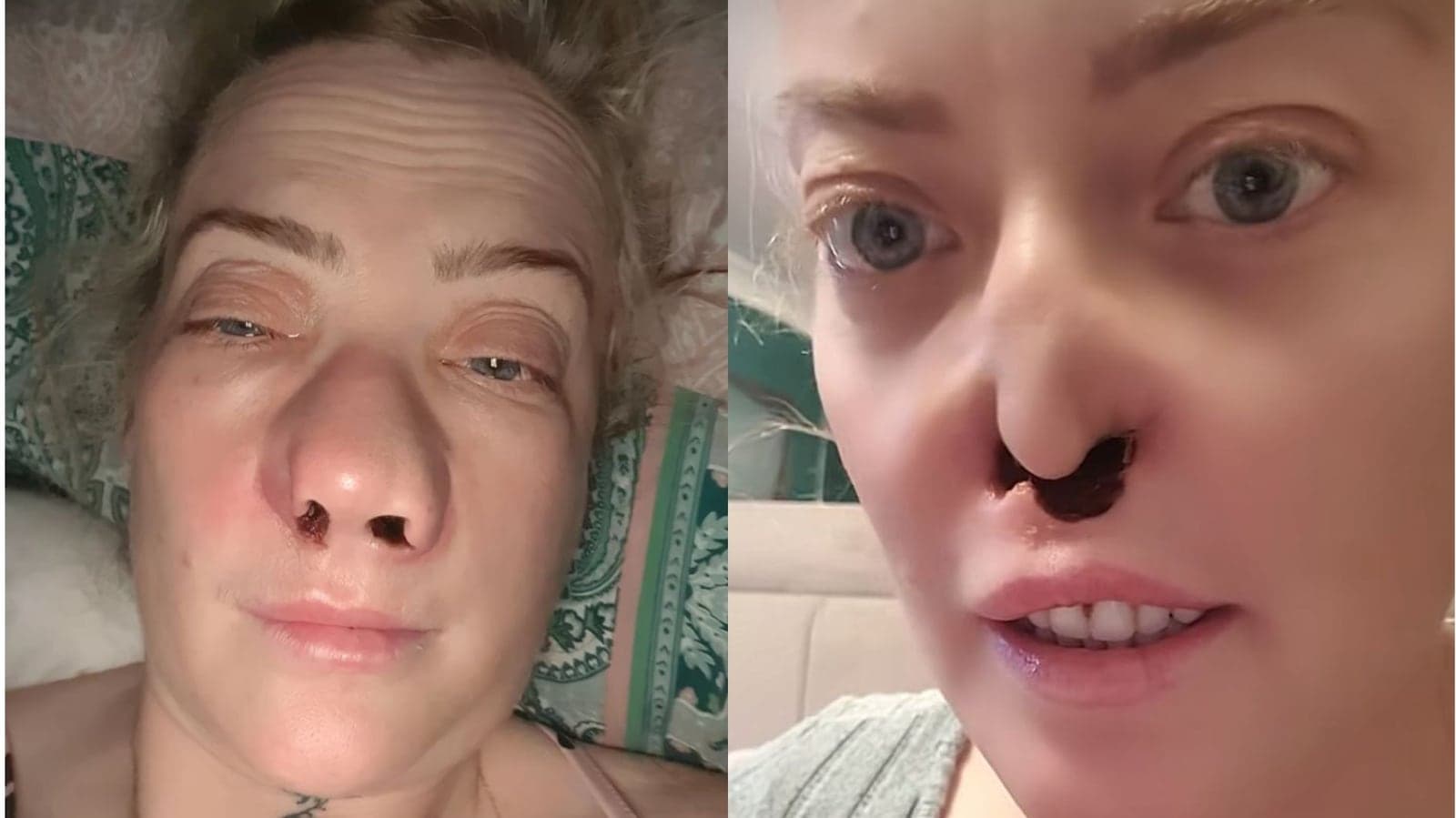 Mulher faz tratamento dentário e fica com ‘buraco’ no rosto: ‘Estou com medo’